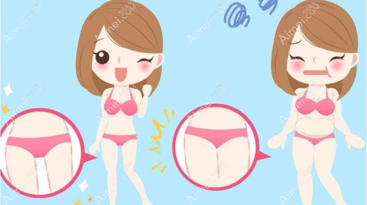 女生梨形身材胯大腿粗可以做抽脂减肥手术矫正