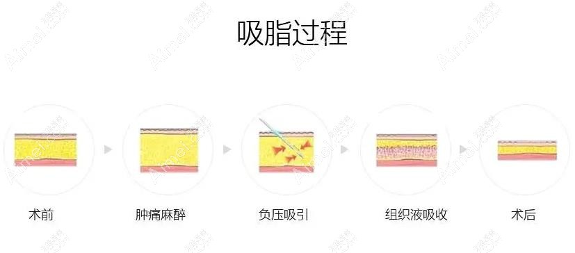常州多美整形资质价格