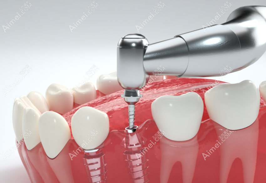 牙科收费价目表2023:正规医院牙科价格表下调种牙,正畸便宜